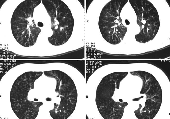 【总结文章“中至二人麻将可以开挂不”揭秘透视辅助万能挂 【总结文章“中至二人麻将可以开挂不”揭秘透视辅助万能挂
